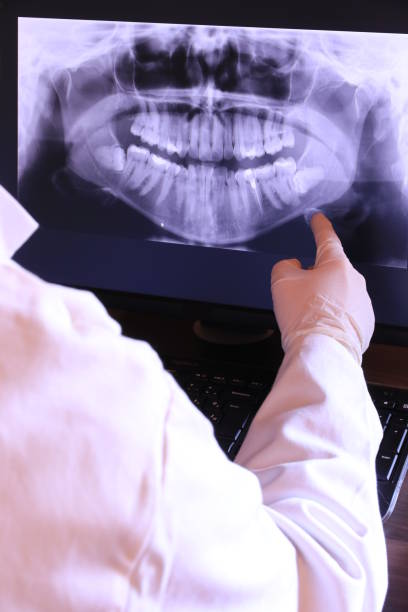 Best Emergency Treatment for Toothache in Batesburg Leesville, SC